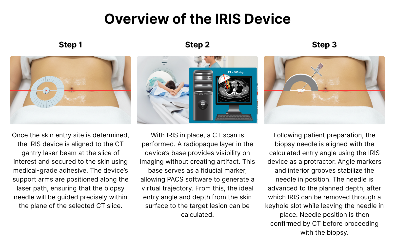 IRIS device